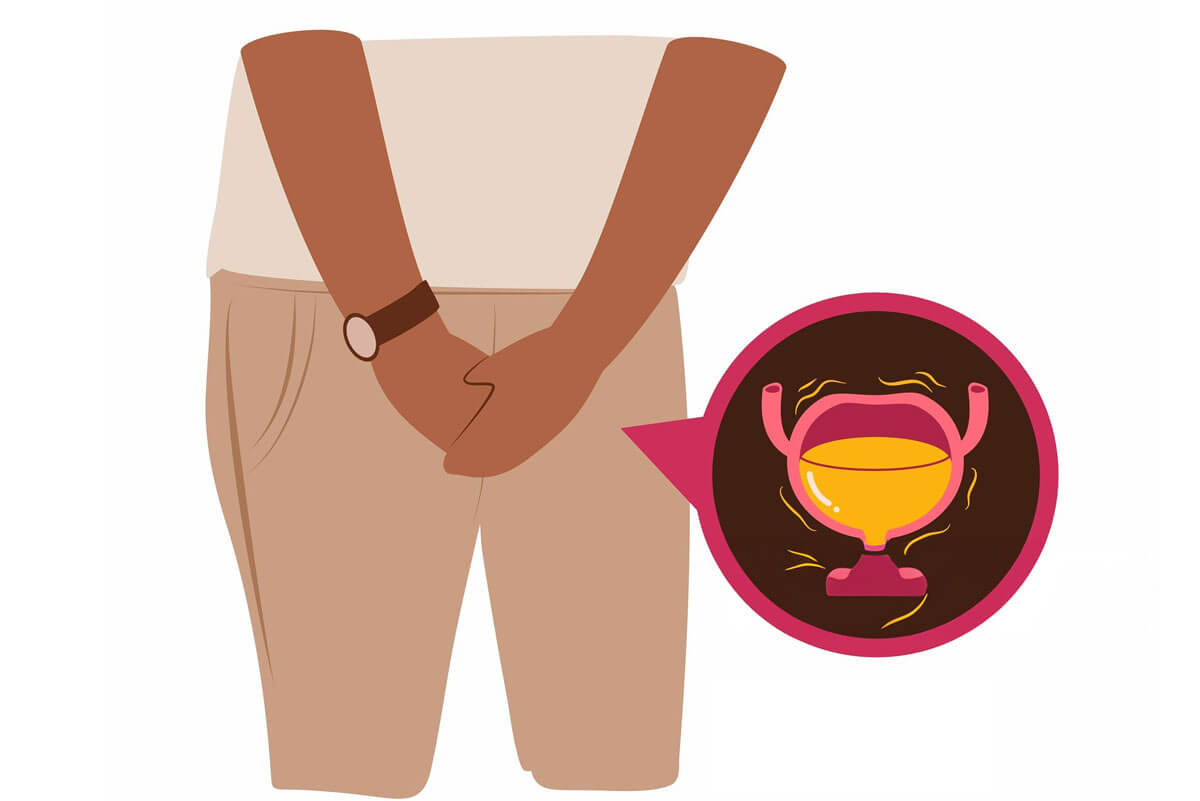 Overactive Bladder (OAB)