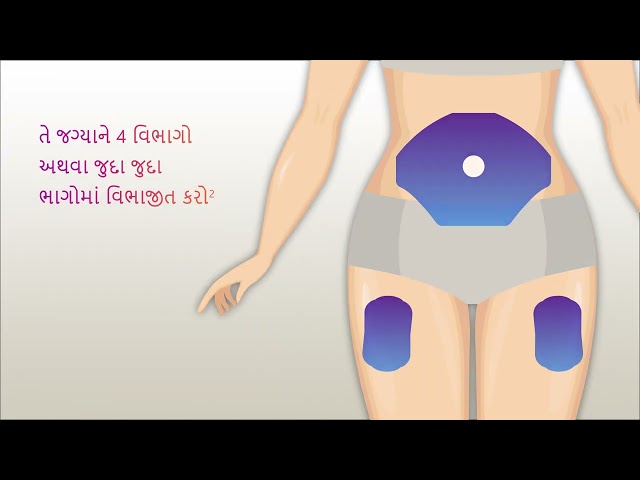 Insulin Injection Site Rotation Gujarati
