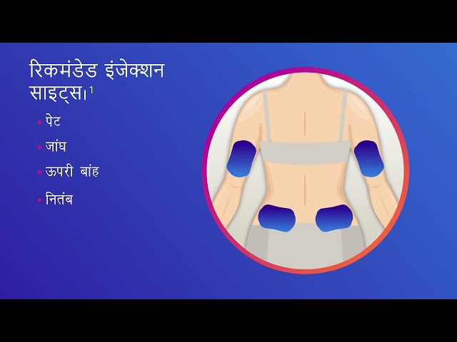 Insulin Injection Site Rotation Hindi